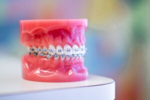 Orthodontic Treatments