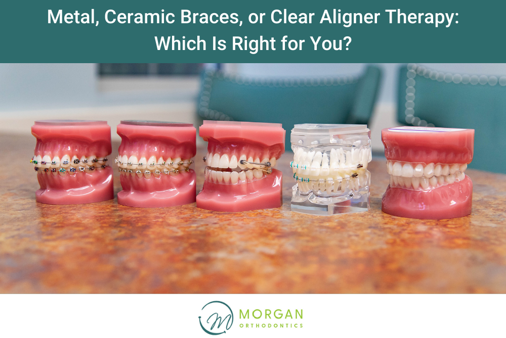 Metal, Ceramic Braces, or Clear Aligner Therapy Which Is Right for You