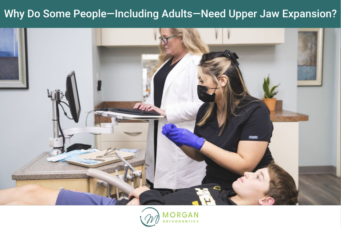 Why Do Some People—Including Adults—Need Upper Jaw Expansion